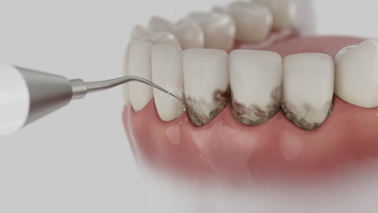 Trusted Dental Crowns And Bridges service in Chinook, MT - Dentist Open Now